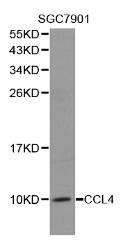 CCL4 / MIP-1 Beta Antibody - Western blot analysis of extracts of SGC-7901 cells, using CCL4 antibody. The secondary antibody used was an HRP Goat Anti-Rabbit IgG (H+L) at 1:10000 dilution. Lysates were loaded 25ug per lane and 3% nonfat dry milk in TBST was used for blocking.