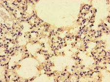 CCL4 / MIP-1 Beta Antibody - Immunohistochemistry of paraffin-embedded human lung tissue at dilution of 1:100