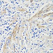 CCL4 / MIP-1 Beta Antibody - Immunohistochemistry of paraffin-embedded Human colon using CCL4 Polyclonal Antibody at dilution of 1:100 (40x lens).