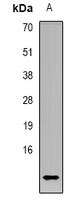 CCL4L1 Antibody - Western blot analysis of CCL4L1 expression in K562 (A) whole cell lysates.