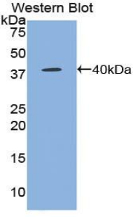 CCL5 / RANTES Antibody - Western blot of recombinant CCL5 / RANTES.  This image was taken for the unconjugated form of this product. Other forms have not been tested.