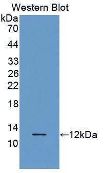 CCL5 / RANTES Antibody - Western blot of CCL5 / RANTES antibody.