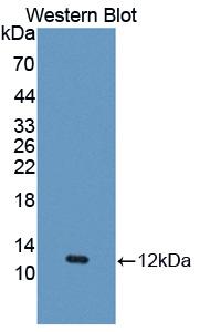 CCL5 / RANTES Antibody - Western blot of CCL5 / RANTES antibody.