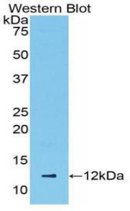 CCL5 / RANTES Antibody - Western blot of recombinant CCL5 / RANTES.  This image was taken for the unconjugated form of this product. Other forms have not been tested.