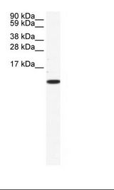 CCL5 / RANTES Antibody - NIH 3T3 Cell Lysate.  This image was taken for the unconjugated form of this product. Other forms have not been tested.