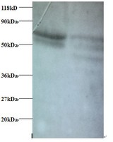 CCL5 / RANTES Antibody - Western blot of C-C motif chemokine 5 antibody at 2 ug/ml. Lane 1: EC109 whole cell lysate. Lane 2: 293T whole cell lysate . Secondary: Goat polyclonal to Rabbit IgG at 1:15000 dilution . Predicted band size: 10 kDa . Observed band size: 70 kDa.  This image was taken for the unconjugated form of this product. Other forms have not been tested.