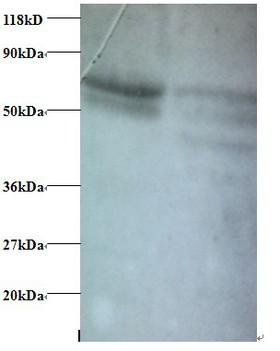 CCL5 / RANTES Antibody - Western blot of C-C motif chemokine 5 antibody at 2 ug/ml. Lane 1: EC109 whole cell lysate. Lane 2: 293T whole cell lysate . Secondary: Goat polyclonal to Rabbit IgG at 1:15000 dilution . Predicted band size: 10 kDa . Observed band size: 70 kDa.  This image was taken for the unconjugated form of this product. Other forms have not been tested.