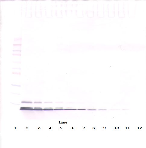 CCL5 / RANTES Antibody - Anti-Human RANTES (CCL5) Western Blot Unreduced
