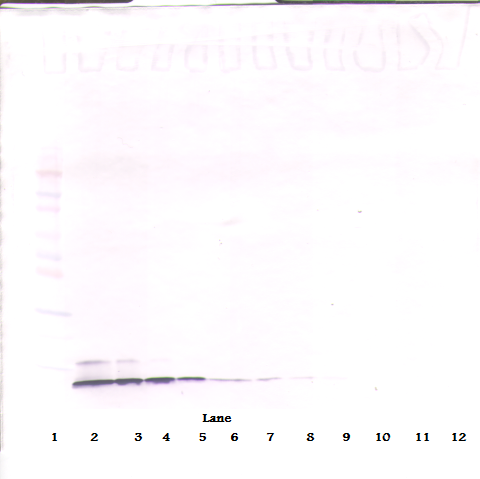 CCL5 / RANTES Antibody - Anti-Human RANTES (CCL5) Western Blot Reduced