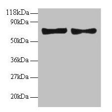 CCL5 / RANTES Antibody - Western blot All lanes: C-C motif chemokine 5 antibody at 2µg/ml Lane 1: EC109 whole cell lysate Lane 2: 293T whole cell lysate Secondary Goat polyclonal to rabbit IgG at 1/15000 dilution Predicted band size: 10 kDa Observed band size: 70 kDa