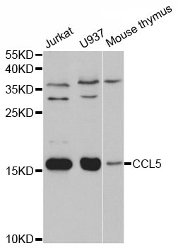 CCL5 / RANTES Antibody - Western blot analysis of extracts of various cell lines, using CCL5 antibody.