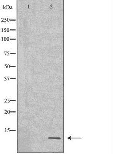CCL5 / RANTES Antibody - Western blot analysis of Jurkat whole cells lysates using CCL5 antibody. The lane on the left is treated with the antigen-specific peptide.