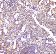 Ccl6 Antibody - IHC analysis of CCL6 using anti-CCL6 antibody. CCL6 was detected in paraffin-embedded section of mouse spleen tissue. Heat mediated antigen retrieval was performed in citrate buffer (pH6, epitope retrieval solution) for 20 mins. The tissue section was blocked with 10% goat serum. The tissue section was then incubated with 2µg/ml rabbit anti-CCL6 antibody overnight at 4°C. Biotinylated goat anti-rabbit IgG was used as secondary antibody and incubated for 30 minutes at 37°C. The tissue section was developed using Strepavidin-Biotin-Complex (SABC) with DAB as the chromogen.