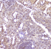 Ccl6 Antibody - IHC staining of FFPE mouse spleen with CCL6 antibody at 2ug/ml. HIER: boil tissue sections in pH6, 10mM citrate buffer, for 10-20 min followed by cooling at RT for 20 min.