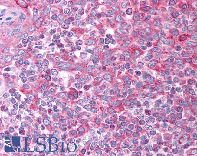 CCL7 / MCP3 Antibody - Anti-CCL7 / MCP3 antibody IHC of human tonsil. Immunohistochemistry of formalin-fixed, paraffin-embedded tissue after heat-induced antigen retrieval. Antibody concentration 5 ug/ml.  This image was taken for the unconjugated form of this product. Other forms have not been tested.