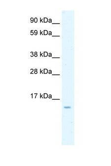 CCL7 / MCP3 Antibody - CCL7 / MCP3 antibody Western blot of Fetal Intestine lysate. Antibody concentration 1 ug/ml. This image was taken for the unconjugated form of this product. Other forms have not been tested.