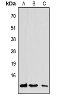 CCL7 / MCP3 Antibody - Western blot analysis of CCL7 expression in HEK293T (A); Raw264.7 (B); PC12 (C) whole cell lysates.