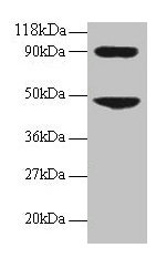 CCL7 / MCP3 Antibody - Western blot C-C motif chemokine 7 antibody at 2µg/ml + 293T whole cell lysate Secondary Goat polyclonal to rabbit IgG at 1/15000 dilution Predicted band size: 11 kDa Observed band size: 48 kDa