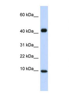 CCL8 / MCP2 Antibody - CCL8 / MCP2 antibody western blot of Fetal Heart lysate. Antibody concentration 1 ug/ml.  This image was taken for the unconjugated form of this product. Other forms have not been tested.