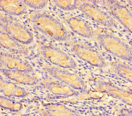 CCL8 / MCP2 Antibody - Immunohistochemistry of paraffin-embedded human small intestine tissue using CCL8 Antibody at dilution of 1:100