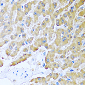 CCL8 / MCP2 Antibody - Immunohistochemistry of paraffin-embedded human liver tissue.