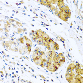 CCL8 / MCP2 Antibody - Immunohistochemistry of paraffin-embedded human stomach tissue.