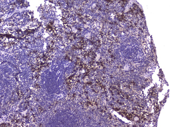 CCL8 / MCP2 Antibody - IHC analysis of CCL8 using anti-CCL8 antibody. CCL8 was detected in paraffin-embedded section of mouse spleen tissue. Heat mediated antigen retrieval was performed in citrate buffer (pH6, epitope retrieval solution) for 20 mins. The tissue section was blocked with 10% goat serum. The tissue section was then incubated with 2µg/ml rabbit anti-CCL8 Antibody overnight at 4°C. Biotinylated goat anti-rabbit IgG was used as secondary antibody and incubated for 30 minutes at 37°C. The tissue section was developed using Strepavidin-Biotin-Complex (SABC) with DAB as the chromogen.