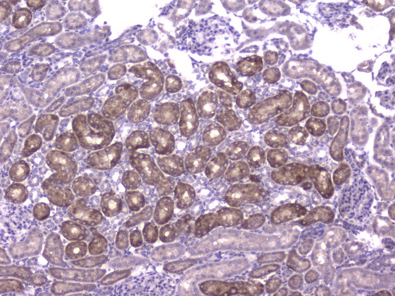 CCL8 / MCP2 Antibody - IHC analysis of CCL8 using anti-CCL8 antibody. CCL8 was detected in paraffin-embedded section of rat kidney tissue. Heat mediated antigen retrieval was performed in citrate buffer (pH6, epitope retrieval solution) for 20 mins. The tissue section was blocked with 10% goat serum. The tissue section was then incubated with 2µg/ml rabbit anti-CCL8 Antibody overnight at 4°C. Biotinylated goat anti-rabbit IgG was used as secondary antibody and incubated for 30 minutes at 37°C. The tissue section was developed using Strepavidin-Biotin-Complex (SABC) with DAB as the chromogen.