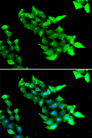 CCM1 / KRIT1 Antibody - Immunofluorescence analysis of HeLa cells.