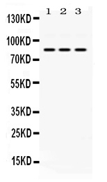 CCM1 / KRIT1 Antibody - Western blot - Anti-KRIT1 Picoband Antibody