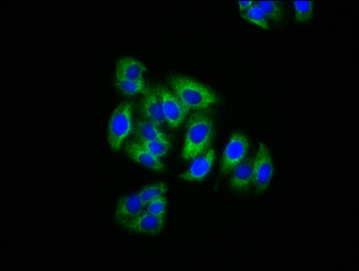 CCM1 / KRIT1 Antibody - Immunofluorescence staining of HepG2 cells with KRIT1 Antibody at 1:200, counter-stained with DAPI. The cells were fixed in 4% formaldehyde, permeabilized using 0.2% Triton X-100 and blocked in 10% normal Goat Serum. The cells were then incubated with the antibody overnight at 4°C. The secondary antibody was Alexa Fluor 488-congugated AffiniPure Goat Anti-Rabbit IgG(H+L).
