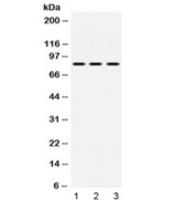 CCM1 / KRIT1 Antibody - Western blot testing of 1) rat heart, 2) mouse NIH 3T3 and 3) human HeLa lysate with KRIT1 antibody at 0.5ug/ml. Predicted/observed molecular weight: ~84 kDa.