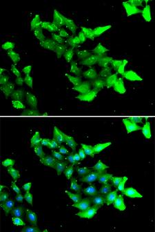 CCM1 / KRIT1 Antibody - Immunofluorescence analysis of HeLa cells using KRIT1 Polyclonal Antibody.