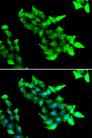 CCM1 / KRIT1 Antibody - Immunofluorescence analysis of HeLa cells using KRIT1 Polyclonal Antibody.