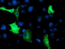 CCM2 / Malcavernin Antibody - Anti-CCM2 mouse monoclonal antibody immunofluorescent staining of COS7 cells transiently transfected by pCMV6-ENTRY CCM2.