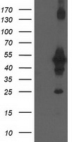 CCM2 / Malcavernin Antibody - HEK293T cells were transfected with the pCMV6-ENTRY control (Left lane) or pCMV6-ENTRY CCM2 (Right lane) cDNA for 48 hrs and lysed. Equivalent amounts of cell lysates (5 ug per lane) were separated by SDS-PAGE and immunoblotted with anti-CCM2.