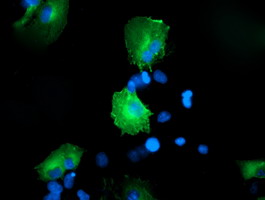 CCM2 / Malcavernin Antibody - Anti-CCM2 mouse monoclonal antibody immunofluorescent staining of COS7 cells transiently transfected by pCMV6-ENTRY CCM2.