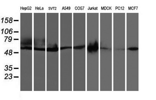 CCM2 / Malcavernin Antibody - Western blot of extracts (35ug) from 9 different cell lines by using anti-CCM2 monoclonal antibody.