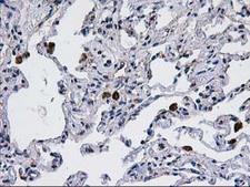 CCM2 / Malcavernin Antibody - IHC of paraffin-embedded Human lung tissue using anti-CCM2 mouse monoclonal antibody. (Heat-induced epitope retrieval by 10mM citric buffer, pH6.0, 100C for 10min).