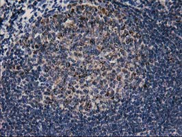 CCM2 / Malcavernin Antibody - IHC of paraffin-embedded Human lymph node tissue using anti-CCM2 mouse monoclonal antibody. (Heat-induced epitope retrieval by 10mM citric buffer, pH6.0, 100C for 10min).