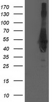 CCM2 / Malcavernin Antibody - HEK293T cells were transfected with the pCMV6-ENTRY control (Left lane) or pCMV6-ENTRY CCM2 (Right lane) cDNA for 48 hrs and lysed. Equivalent amounts of cell lysates (5 ug per lane) were separated by SDS-PAGE and immunoblotted with anti-CCM2.