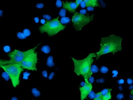 CCM2 / Malcavernin Antibody - Anti-CCM2 mouse monoclonal antibody immunofluorescent staining of COS7 cells transiently transfected by pCMV6-ENTRY CCM2.