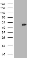 CCM2 / Malcavernin Antibody - HEK293T cells were transfected with the pCMV6-ENTRY control (Left lane) or pCMV6-ENTRY CCM2 (Right lane) cDNA for 48 hrs and lysed. Equivalent amounts of cell lysates (5 ug per lane) were separated by SDS-PAGE and immunoblotted with anti-CCM2.