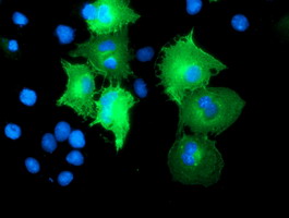 CCM2 / Malcavernin Antibody - Anti-CCM2 mouse monoclonal antibody immunofluorescent staining of COS7 cells transiently transfected by pCMV6-ENTRY CCM2.