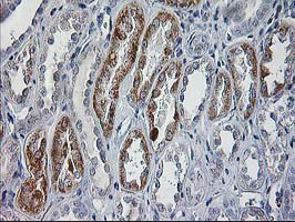 CCM2 / Malcavernin Antibody - IHC of paraffin-embedded Human Kidney tissue using anti-CCM2 mouse monoclonal antibody.