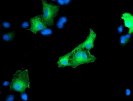 CCM2 / Malcavernin Antibody - Anti-CCM2 mouse monoclonal antibody immunofluorescent staining of COS7 cells transiently transfected by pCMV6-ENTRY CCM2.