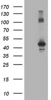 CCM2 / Malcavernin Antibody - HEK293T cells were transfected with the pCMV6-ENTRY control (Left lane) or pCMV6-ENTRY CCM2 (Right lane) cDNA for 48 hrs and lysed. Equivalent amounts of cell lysates (5 ug per lane) were separated by SDS-PAGE and immunoblotted with anti-CCM2.
