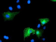 CCM2 / Malcavernin Antibody - Anti-CCM2 mouse monoclonal antibody immunofluorescent staining of COS7 cells transiently transfected by pCMV6-ENTRY CCM2.