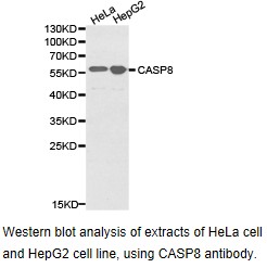 CCM2 / Malcavernin Antibody - Western blot.
