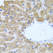 CCM2 / Malcavernin Antibody - Immunohistochemistry of paraffin-embedded human liver tissue.